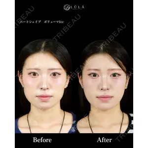 ルラ美容クリニック 池袋院 小海 元｜長期休暇につき指名不可医師の症例