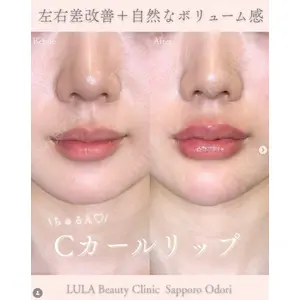 ルラ美容クリニック 札幌大通り院 能登 貴弘医師の症例