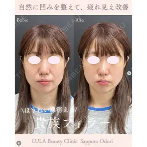 ルラ美容クリニック 札幌大通り院 能登 貴弘医師の症例