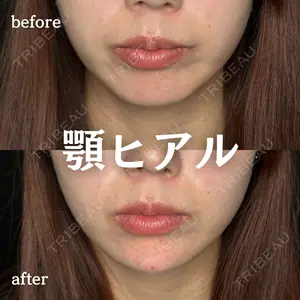 ルラ美容クリニック 新宿院 陶 美梨医師の症例