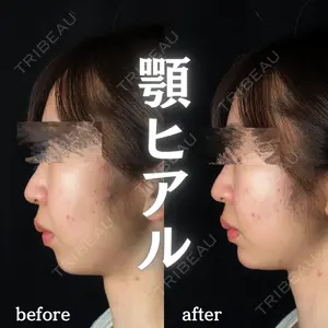 ルラ美容クリニック 新宿院 陶 美梨医師の症例