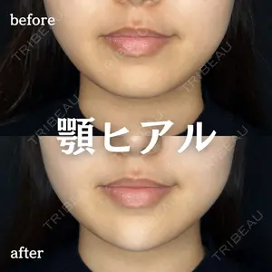 ルラ美容クリニック 新宿院 陶 美梨医師の症例