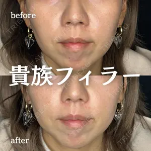 ルラ美容クリニック 新宿院 陶 美梨医師の症例