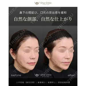 Otus Clinic 【オータスクリニック】 中 徳太郎医師の症例