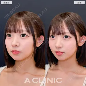 A CLINIC（エークリニック） 池袋院 片桐 大佑医師の症例