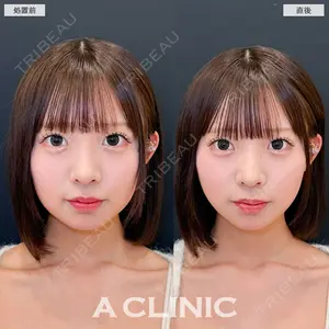 A CLINIC（エークリニック） 池袋院 片桐 大佑医師の症例