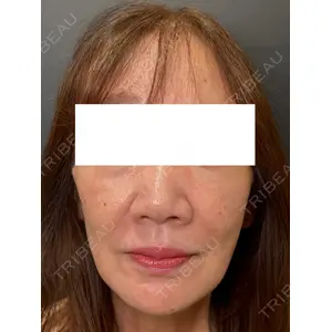 Ledian Clinic六本木 奥村 瞬医師の症例