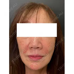 Ledian Clinic六本木 奥村 瞬医師の症例