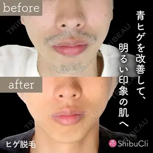 渋谷美容外科クリニック 新宿院の症例