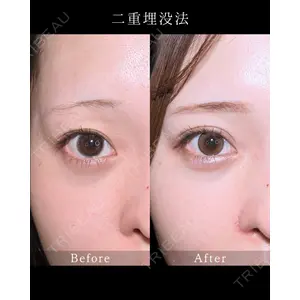 藤・ナチュレ美容クリニック 銀座院 小川 杏平医師の症例