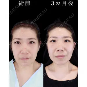 HAAB BEAUTY CLINIC 南青山本院（新院） 小平 佳典医師の症例