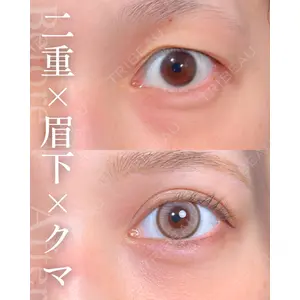 東京シンデレラ美容外科 大宮院 竹田 昌平医師の症例