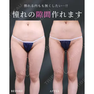 ガーデンクリニック 大阪院 荒川 尚士医師の症例