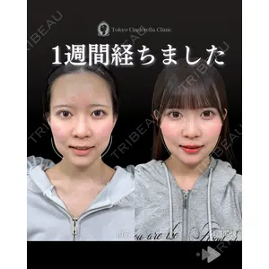東京シンデレラ美容外科 池袋院 石井 達也医師の症例