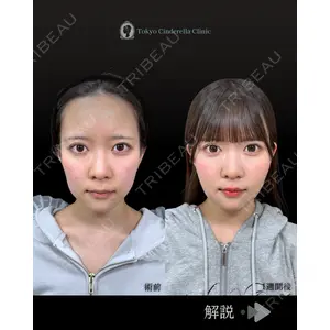 東京シンデレラ美容外科 池袋院 石井 達也医師の症例