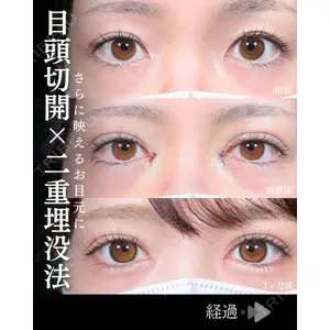 東京シンデレラ美容外科 池袋院 石井 達也医師の症例