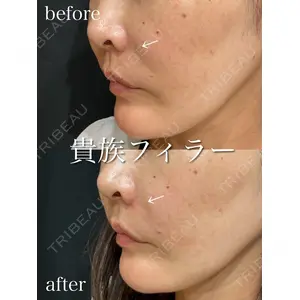 アデル美容クリニックの症例