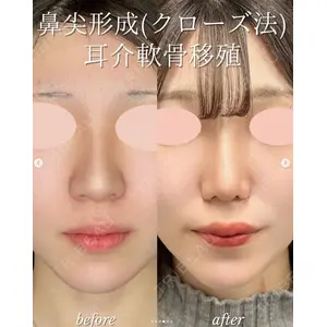 ルラ美容クリニック 札幌大通り院 能登 貴弘医師の症例