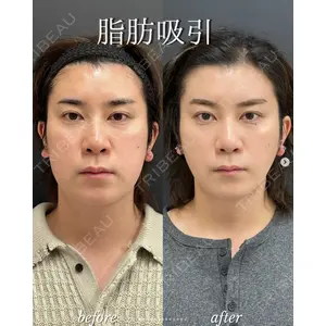 ルラ美容クリニック 札幌大通り院 能登 貴弘医師の症例