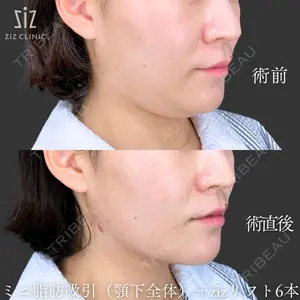 ziz CLINIC 村岡 史子医師の症例