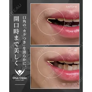 Otus Clinic 【オータスクリニック】 中 徳太郎医師の症例