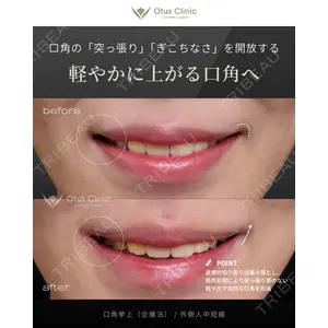 Otus Clinic 【オータスクリニック】 中 徳太郎医師の症例