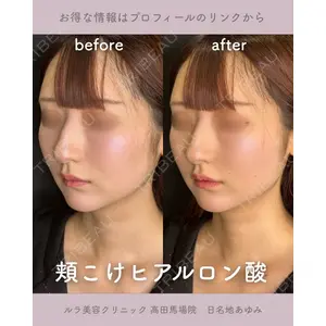 ルラ美容クリニック 高田馬場院 日名地 あゆみ医師の症例