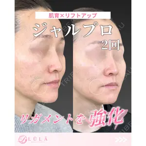 ルラ美容クリニック 福岡本院 樋勝 政博医師の症例