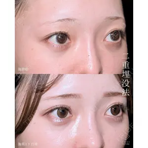 藤・ナチュレ美容クリニック 銀座院 小川 杏平医師の症例