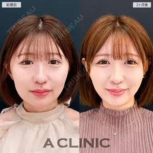 A CLINIC（エークリニック） 大阪院の症例