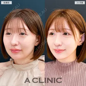 A CLINIC（エークリニック） 大阪院の症例