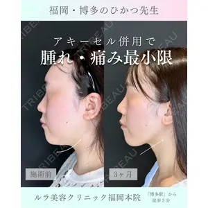 ルラ美容クリニック 福岡本院 樋勝 政博医師の症例