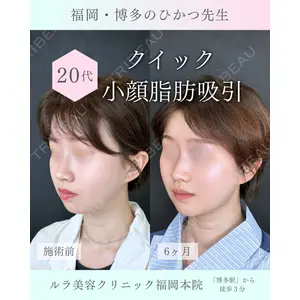 ルラ美容クリニック 福岡本院 樋勝 政博医師の症例