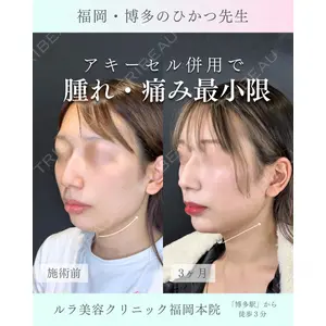 ルラ美容クリニック 福岡本院 樋勝 政博医師の症例
