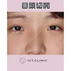 千葉美容外科アイビークリニックの症例