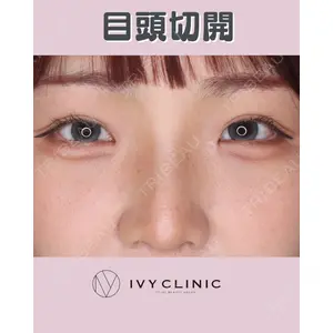 千葉美容外科アイビークリニックの症例