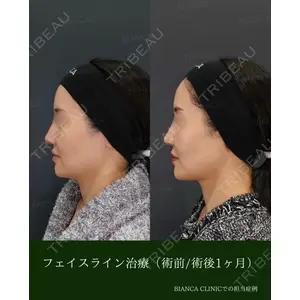 BIANCA銀座 雜賀 俊行医師の症例