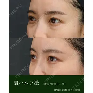 BIANCA銀座 雜賀 俊行医師の症例