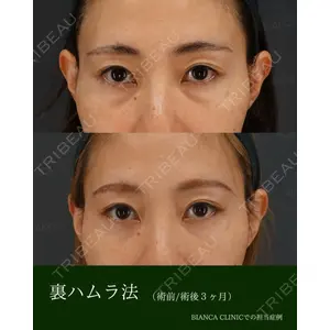 BIANCA銀座 雜賀 俊行医師の症例