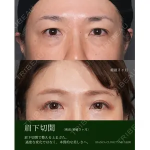 BIANCA銀座 雜賀 俊行医師の症例