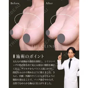 THE CLINIC（ザ・クリニック） 東京院 吉田 有希医師の症例