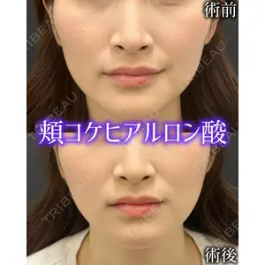 ルラ美容クリニック 広島院 杉本 祥平医師の症例