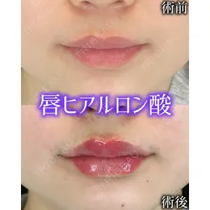 ルラ美容クリニック 広島院 杉本 祥平医師の症例