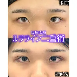 ルラ美容クリニック 広島院 杉本 祥平医師の症例