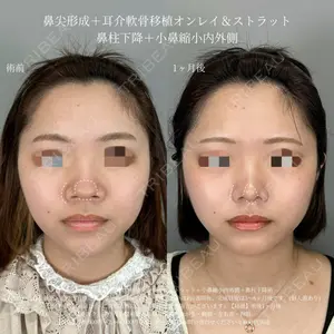 ASTRA BEAUTY CLINICの症例