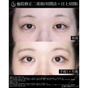 聖心美容クリニック 横浜院 川端 智貴医師の症例