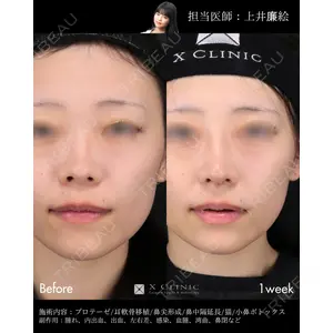 X CLINIC 恵比寿院 上井 廉絵医師の症例
