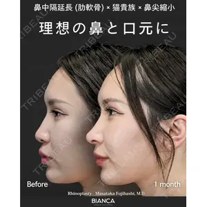 BIANCA銀座 藤橋 政尭医師の症例