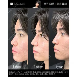 X CLINIC 恵比寿院 上井 廉絵医師の症例
