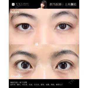 X CLINIC 恵比寿院 上井 廉絵医師の症例